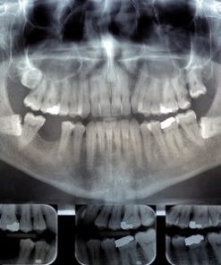 Dental Radiology