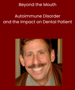 Beyond the Mouth- Autoimmune Disorder and the Impact on Dental Patient